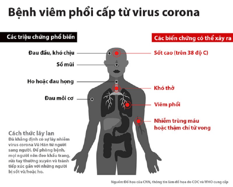 Virus Covid-19 gây ra những triệu chứng tương đối giống Cúm mùa nhưng tốc độ lây lan nhanh gấp bội, biến chứng rất nguy hiểm