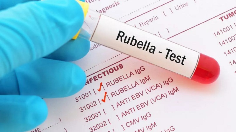 Mẫu test chẩn đoán bệnh Rubella