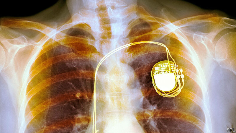 Cần thông báo cho chuyên viên kỹ thuật về việc có đang sử dụng thiết bị kim loại như máy tạo nhịp tim