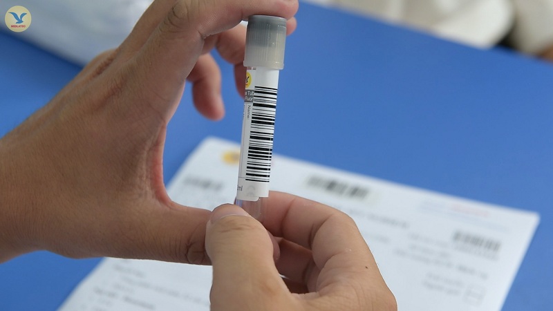 Xét nghiệm ADN với mẫu máu cho kết quả với độ chính xác cao