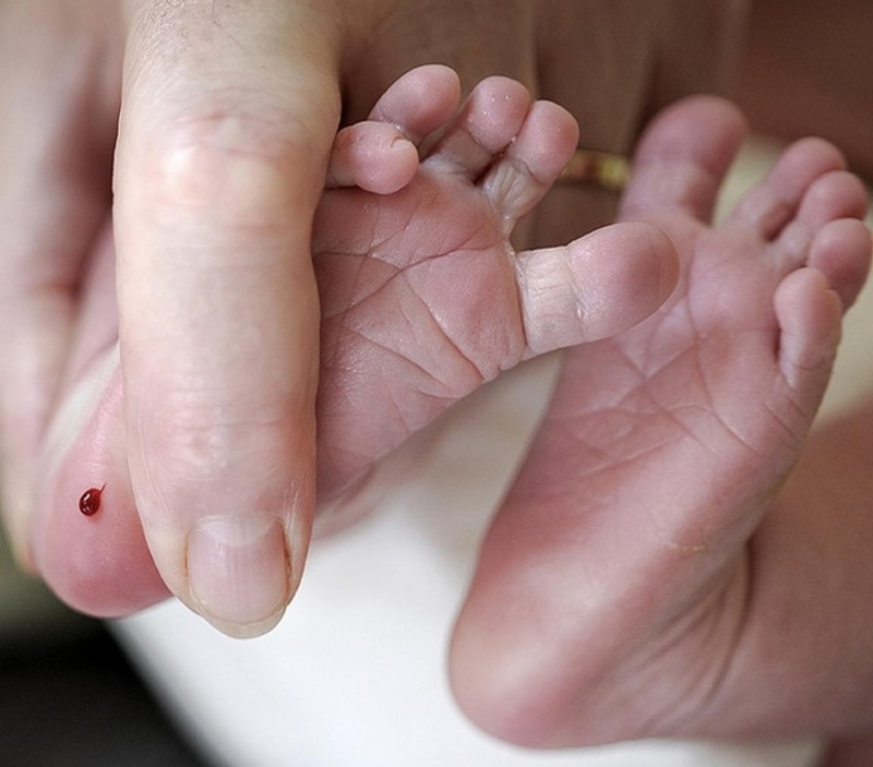 Xét nghiệm sơ sinh trên mẫu máu gót chân khá phổ biến