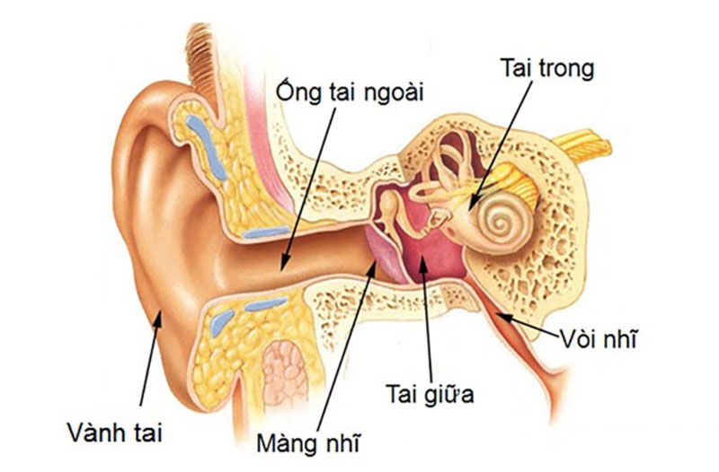 Khi bị viêm tai giữa, hõm nhĩ và xương chũm đều bị nhiễm trùng.