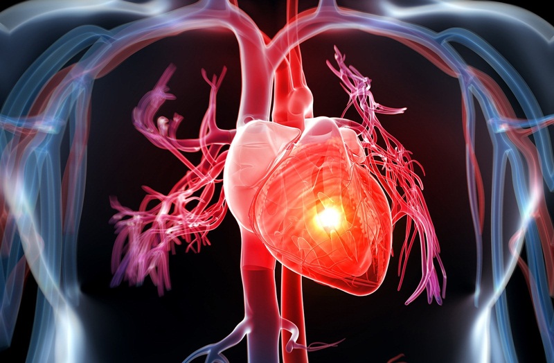Bệnh tim mạch thuộc nhóm những bệnh nguy hiểm hàng đầu.
