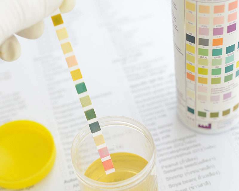 Hình 1: Giá trị pH được thể hiện trên que thử nước tiểu