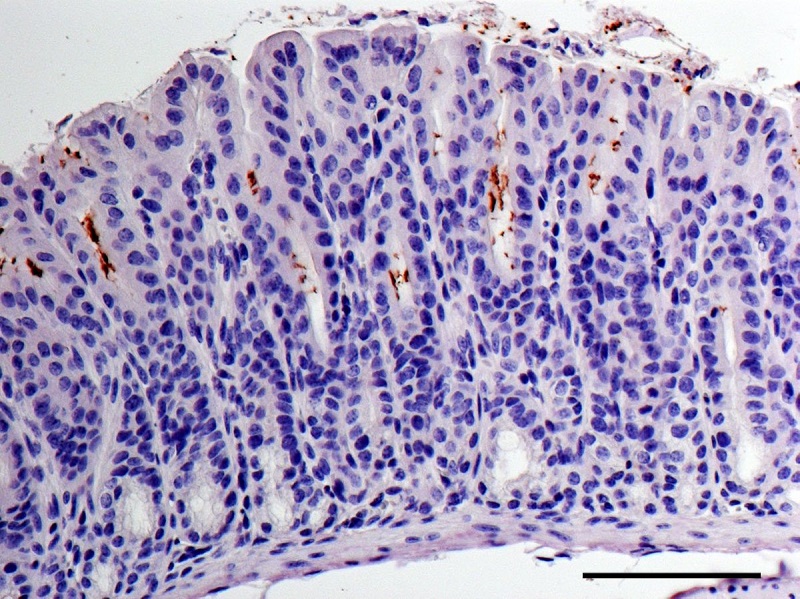 Hình ảnh vi khuẩn H. pylori (màu nâu) trên lam nhuộm tế bào