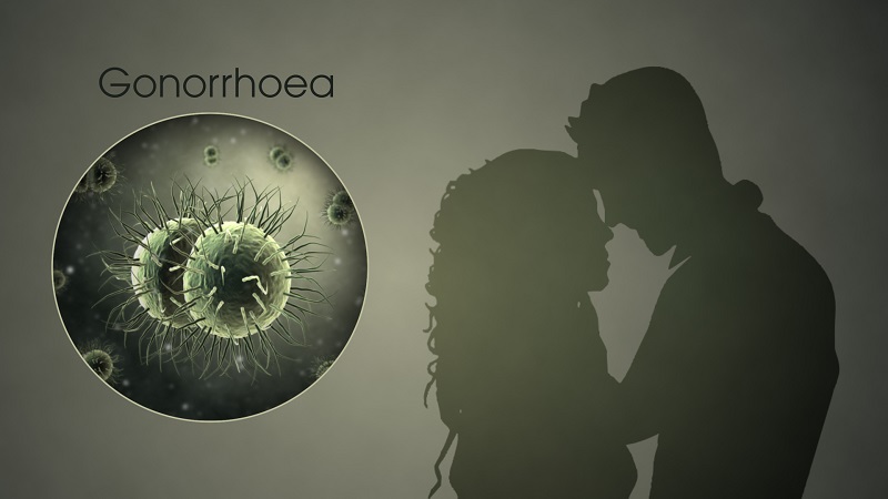 Nhiễm bệnh lậu do vi khuẩn Neisseria gonorrhoeae gây nên