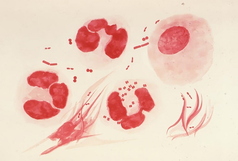 Hình ảnh song cầu Neisseria gonorrhoeae gây bệnh