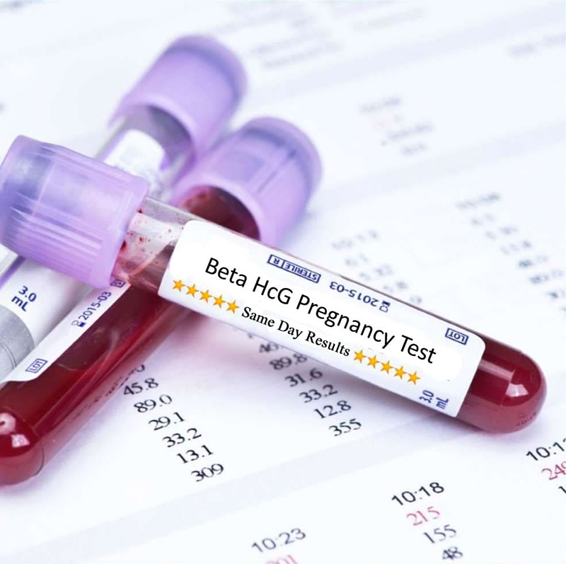 Có thể phát hiện có thai hay không dựa vào nồng độ beta hCG trong máu, nước tiểu