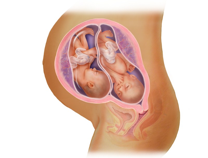 Xét nghiệm beta hCG tăng có thể là dấu hiệu của đa thai