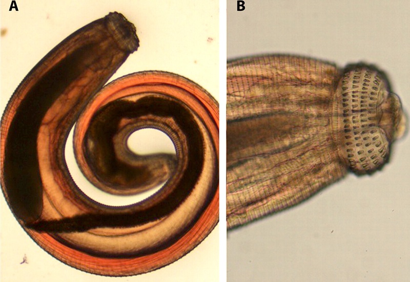 Hình ảnh 1: Hình ảnh giun đầu gai Gnathostoma spp
