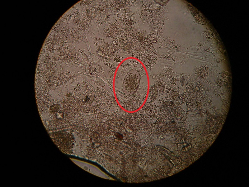 Hình ảnh 2: Hình ảnh trứng giun đầu gai Gnathostoma spp