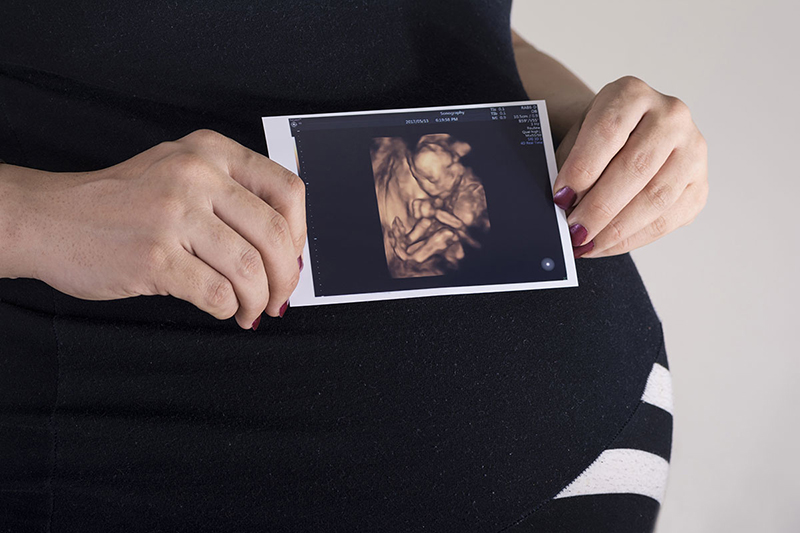 Mẹ bầu thường được chỉ định siêu âm 4D từ tuần thứ 11 trở đi của thai kỳ