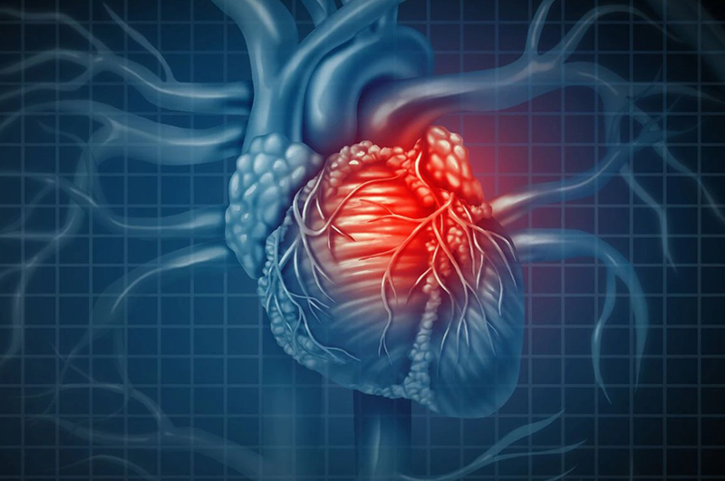 Đau tim rất nguy hiểm bởi nó có thể gây ra những biến chứng nguy hiểm tới tính mạng người bệnh