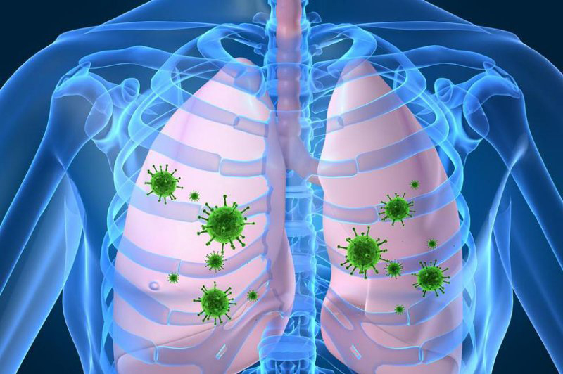 Vi khuẩn, vi rút có trong phổi cũng là nguyên nhân gây nên tràn dịch màng phổi