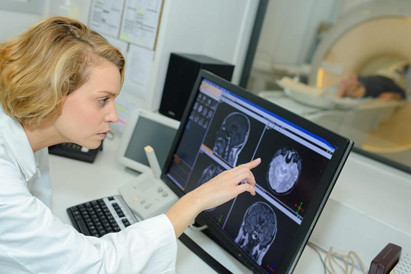 Có thể phát hiện các khối u não thông qua hình ảnh chụp MRI