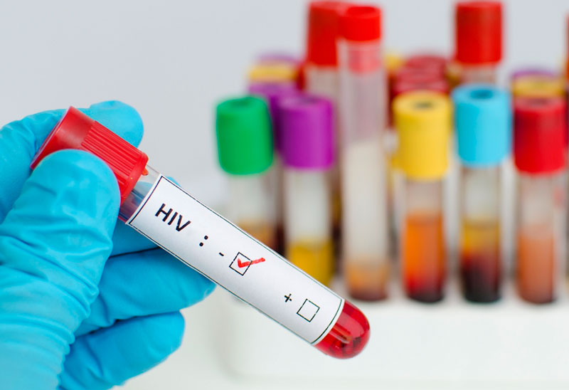 Lựa chọn thời điểm xét nghiệm HIV phù hợp