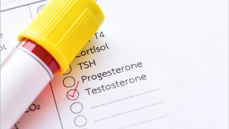  Xét nghiệm Testosterone kiểm tra sức khỏe sinh sản 