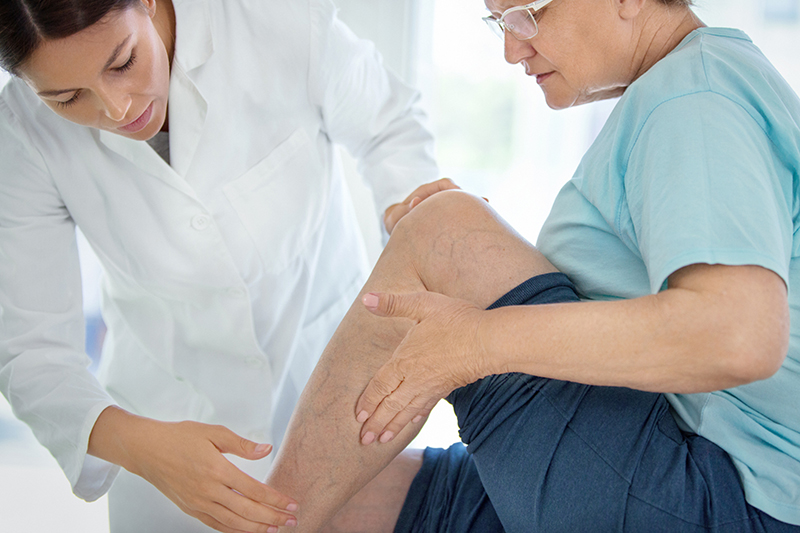 Bác sĩ kiểm tra và tư vấn bệnh giãn tĩnh mạch chân có nguy hiểm không