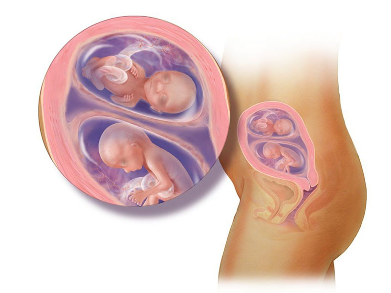 Những nguy cơ của việc mang thai khi bị u xơ tử cung 