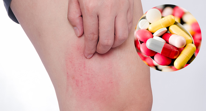 Cơ chế tác dụng của kháng sinh có thể gây nổi mẩn trên da