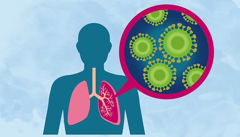 Có nhiều nguyên nhân dẫn đến hiện tượng viêm nhiễm ở phổi bao gồm các loại virus, vi khuẩn, nấm, chất độc hại, môi trường