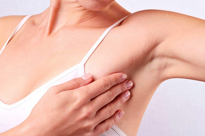 Khối u xuất hiện ở nách hoặc vú là một trong những dấu hiệu của bệnh 