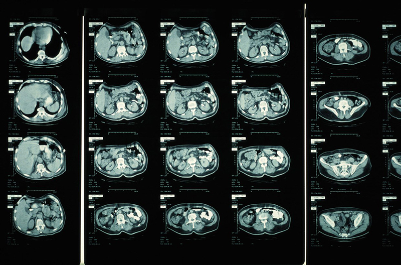 Hình ảnh cắt lớp điện toán CT scan được tổng hợp