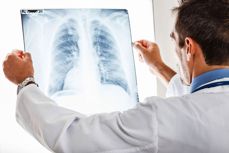 Các dịch vụ khám sức khỏe thường bao gồm chụp X-quang