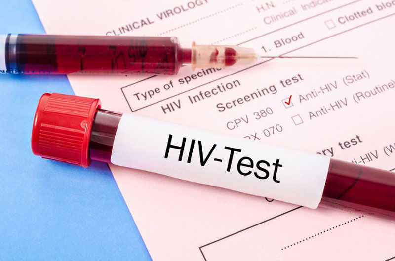 Xét nghiệm để tìm cơ sở chẩn đoán bệnh HIV