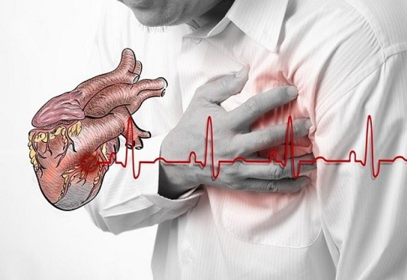 Tình trạng thiếu máu cơ tim nếu không được chữa trị kịp thời có thể dẫn tới nhồi máu cơ tim và tử vong