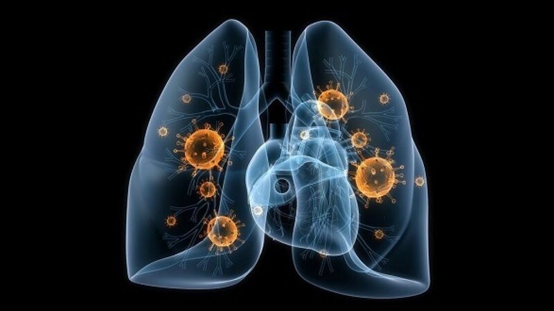 Viêm phổi ở trẻ nhỏ có thể nguy hiểm đến tính mạng
