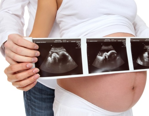 Không phải siêu âm nhiều là tốt, có 3 mốc siêu âm thai quan trọng mẹ bầu cần nhớ