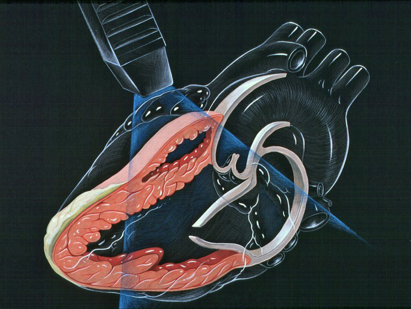 Siêu âm Doppler tim giúp đánh giá và phát hiện các dấu hiệu bất thường của hệ thống tim mạch