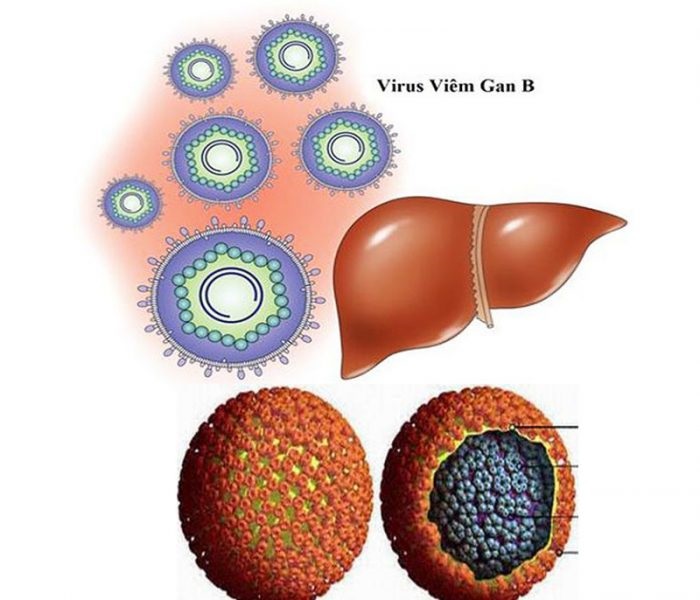 Viêm gan B do virus HBV gây ra, ảnh hưởng xấu đến gan