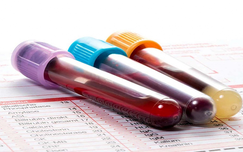 Chi phí xét nghiệm máu phụ thuộc vào nhiều yếu tố