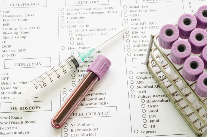 Xét nghiệm HCV được chia thành 3 loại chính