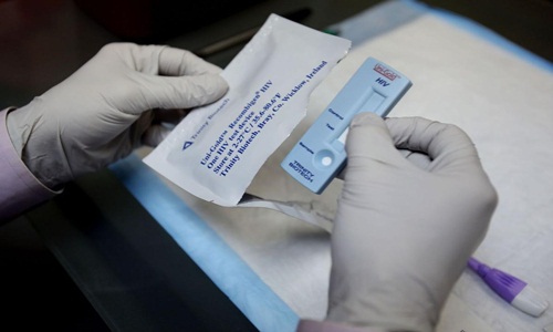 xét nghiệm HIV cần thực hiện tại cơ sở y tế uy tín