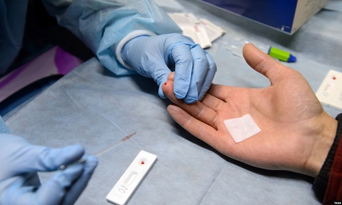 xét nghiệm HIV càng sớm càng tốt nhắm tránh lây lan cho cộng đồng