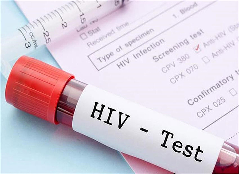 Tầm soát HIV là việc làm hết sức cần thiết và quan trọng