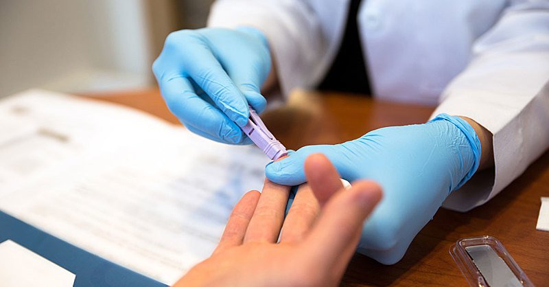 Lấy mẫu bệnh phẩm xét nghiệm HIV