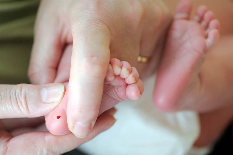 Xét nghiệm máu gót chân là thủ thuật xét nghiệm dành cho trẻ sơ sinh