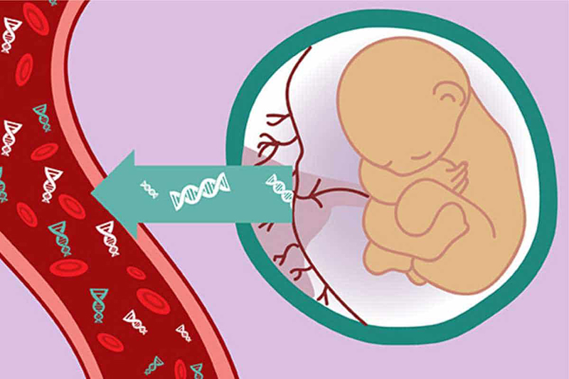 Xét nghiệm sàng lọc trước khi sinh NIPT dựa vào các DNA tự do của thai nhi có trong máu mẹ