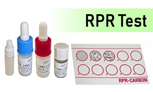 Xét nghiệm chẩn đoán bệnh giang mai không đặc hiệu - RPR