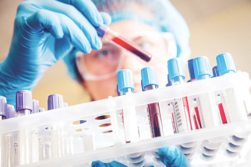 Xét nghiệm sốt xuất huyết được kết hợp với các phương pháp xét nghiệm khác