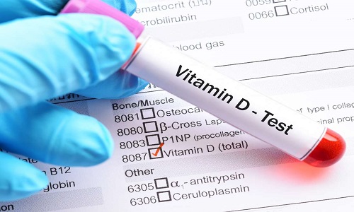 Xét nghiệm vi chất vitamin D