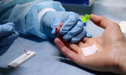 Xét nghiệm chẩn đoán HIV bằng phương pháp huyết thanh học tại Bệnh viện đa khoa MEDLATEC