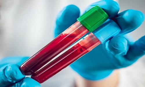 Các xét nghiệm hỗ trợ chẩn đoán nhiễm khuẩn huyết