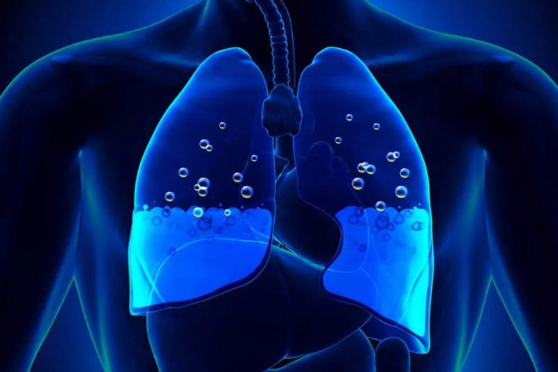 Bệnh nhân <a href='https://medlatec.vn/tu-dien-benh-ly/tran-dich-mang-phoi-sjZWL'  title ='tràn dịch màng phổi'>tràn dịch màng phổi</a> cần được cấp cứu kịp thời
