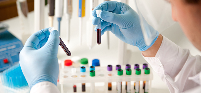 Có 8 chỉ số cơ bản khi thực hiện xét nghiệm sinh hóa máu