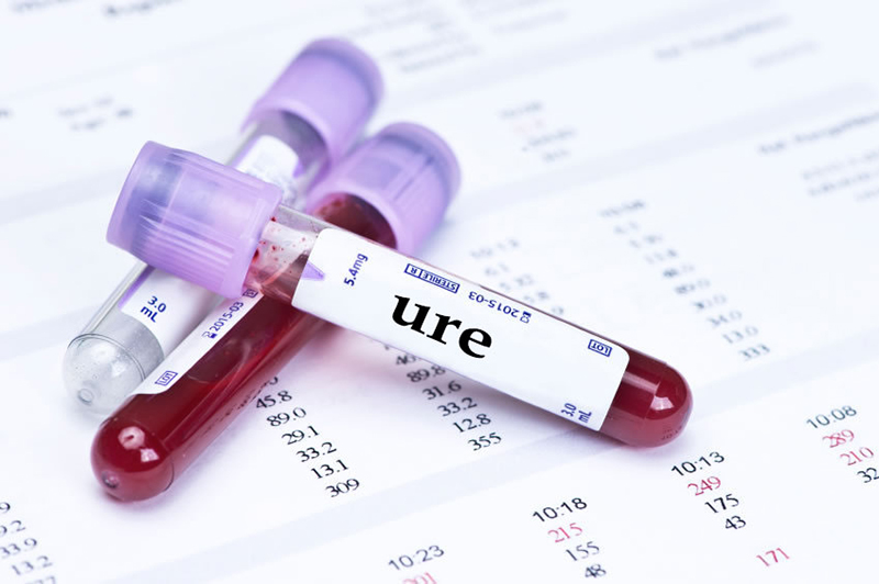 Ure là một trong những chỉ số cơ bản trong xét nghiệm sinh hóa máu